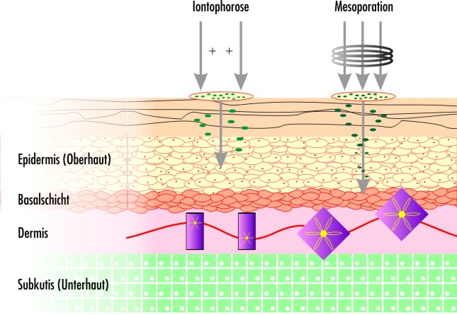 Mesoporation